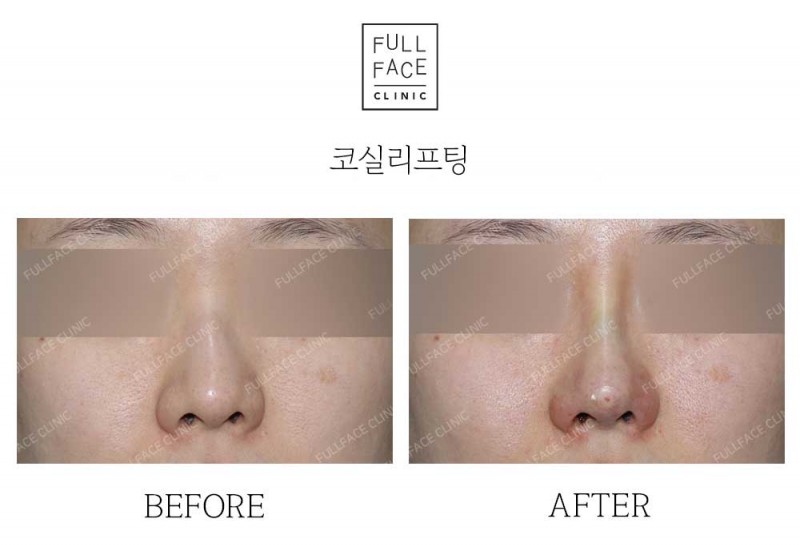 시그니처올림포스코프팅(24.9.11.6→24.11.14)