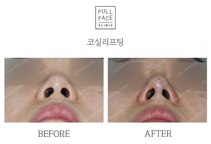 시그니처올림포스코프팅(24.9.11.6→24.11.14)