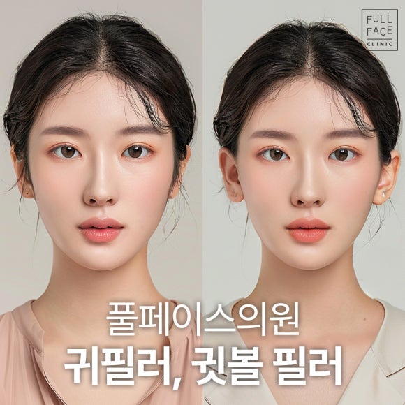 귀필러 상담 전 꼭 읽어보세요! 누운귀, 귓볼필러 부작용 없이 받는 방법 대공개 의사작성